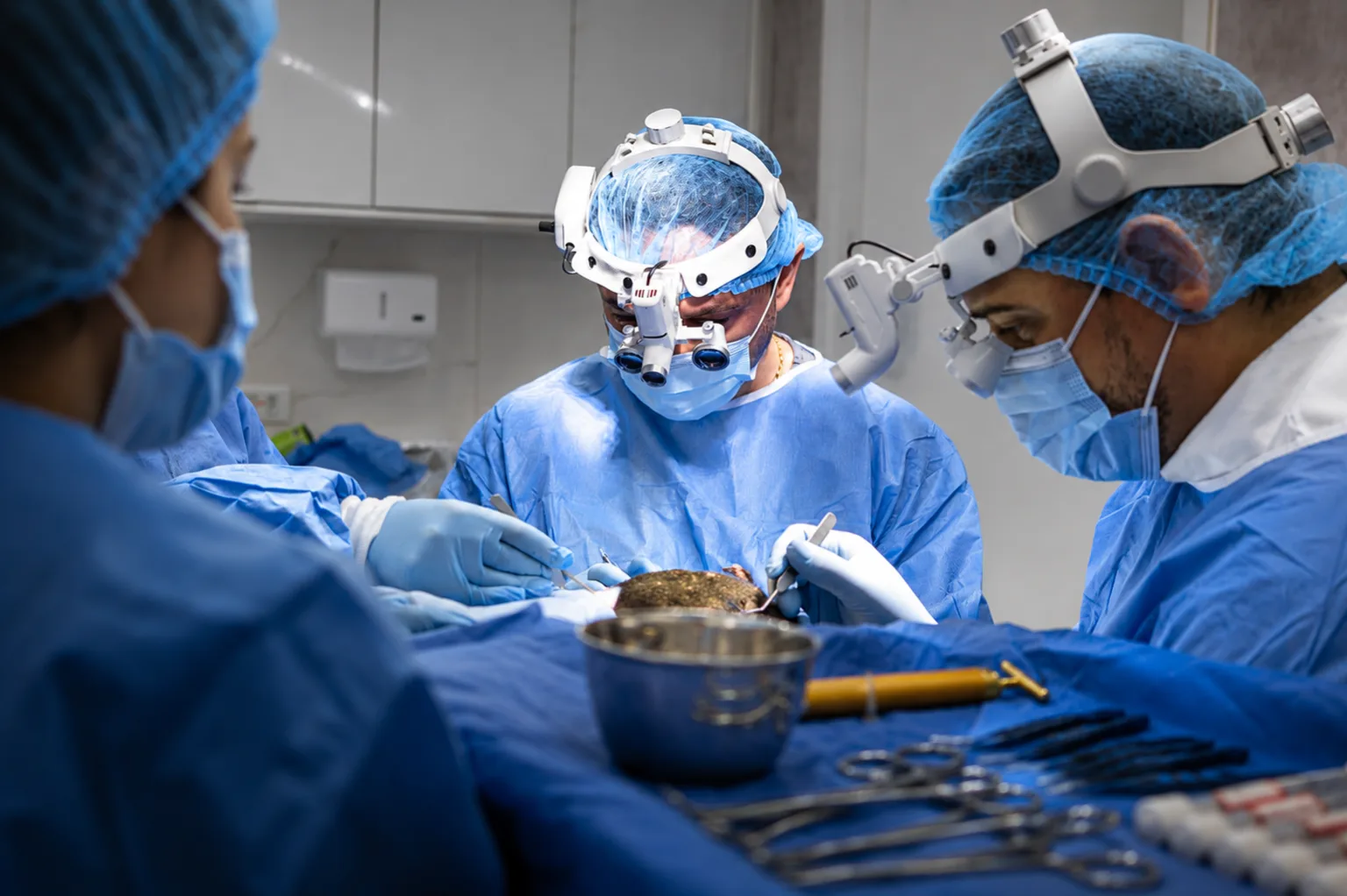 Dr. Mozart e equipe durante um transplante capilar, com lupas cirúrgicas